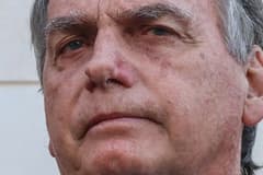 Exames de Bolsonaro indicam resquícios de inflamações pulmonares